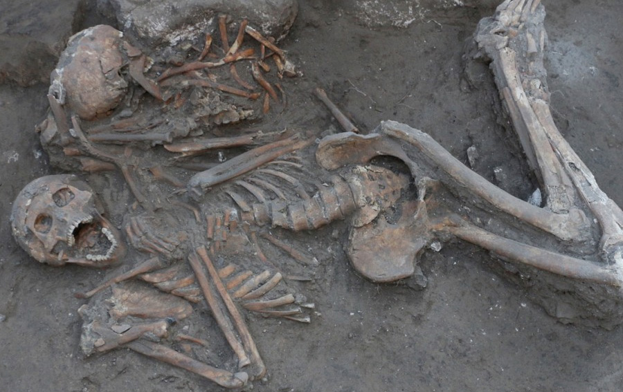 Evidence of Ancient Brain Surgery Found in the Middle East