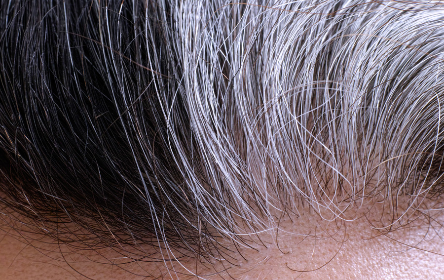 Do ‘Stuck’ Stem Cells Account for Gray Hair?